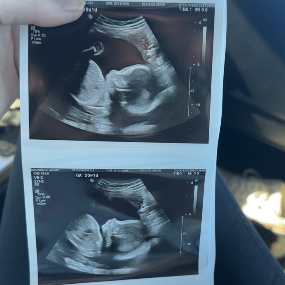 Photo shared by Albany for their Babylist baby registry.