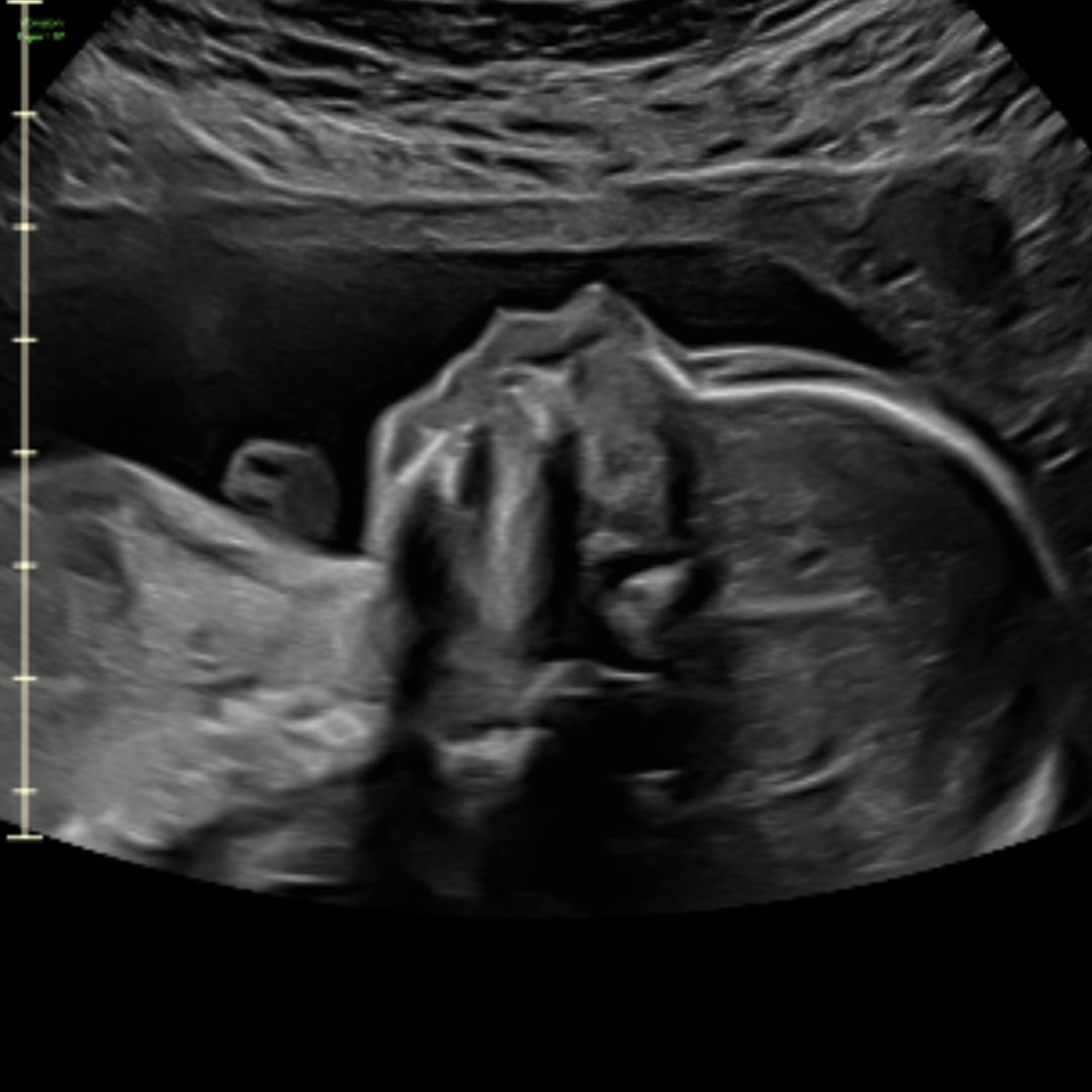 Photo shared by Haley for their Babylist baby registry.