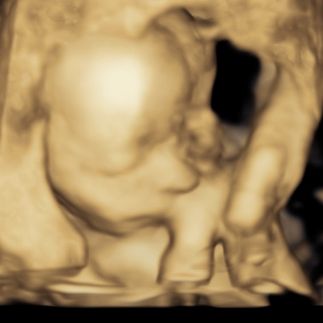 Photo shared by Danielle for their Babylist baby registry.
