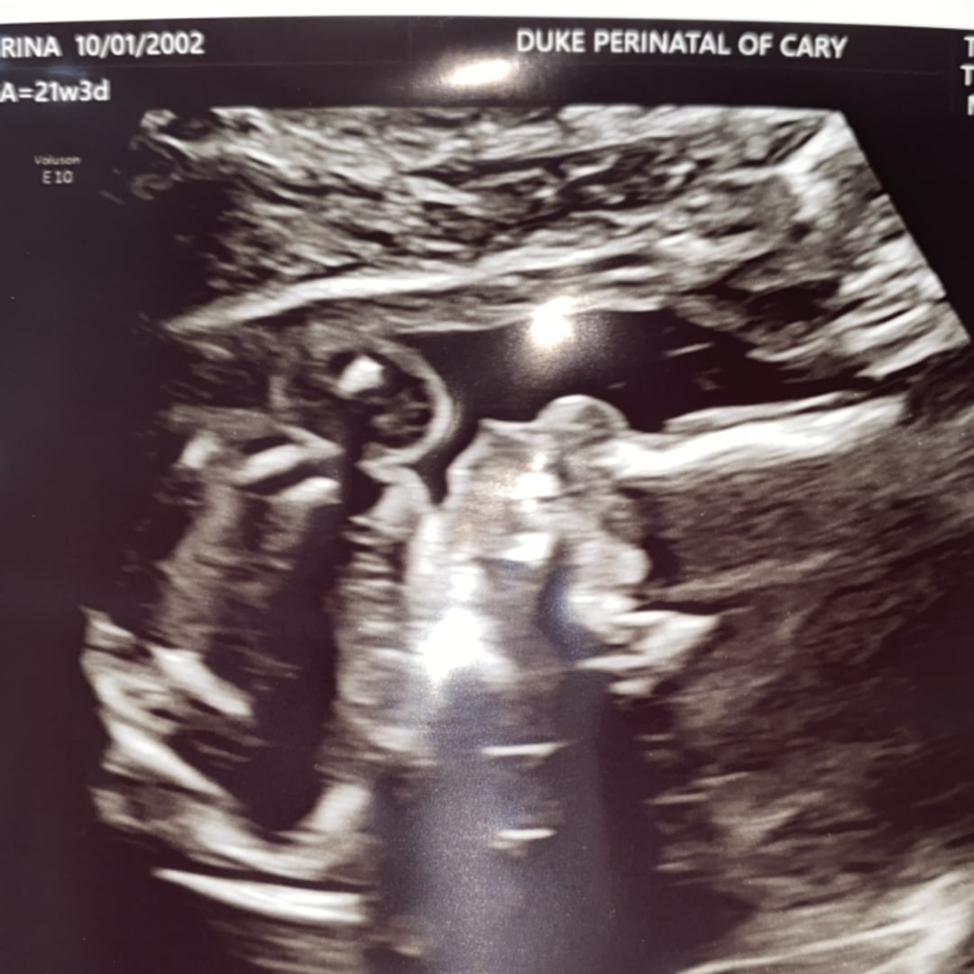Photo shared by Sabrina for their Babylist baby registry.