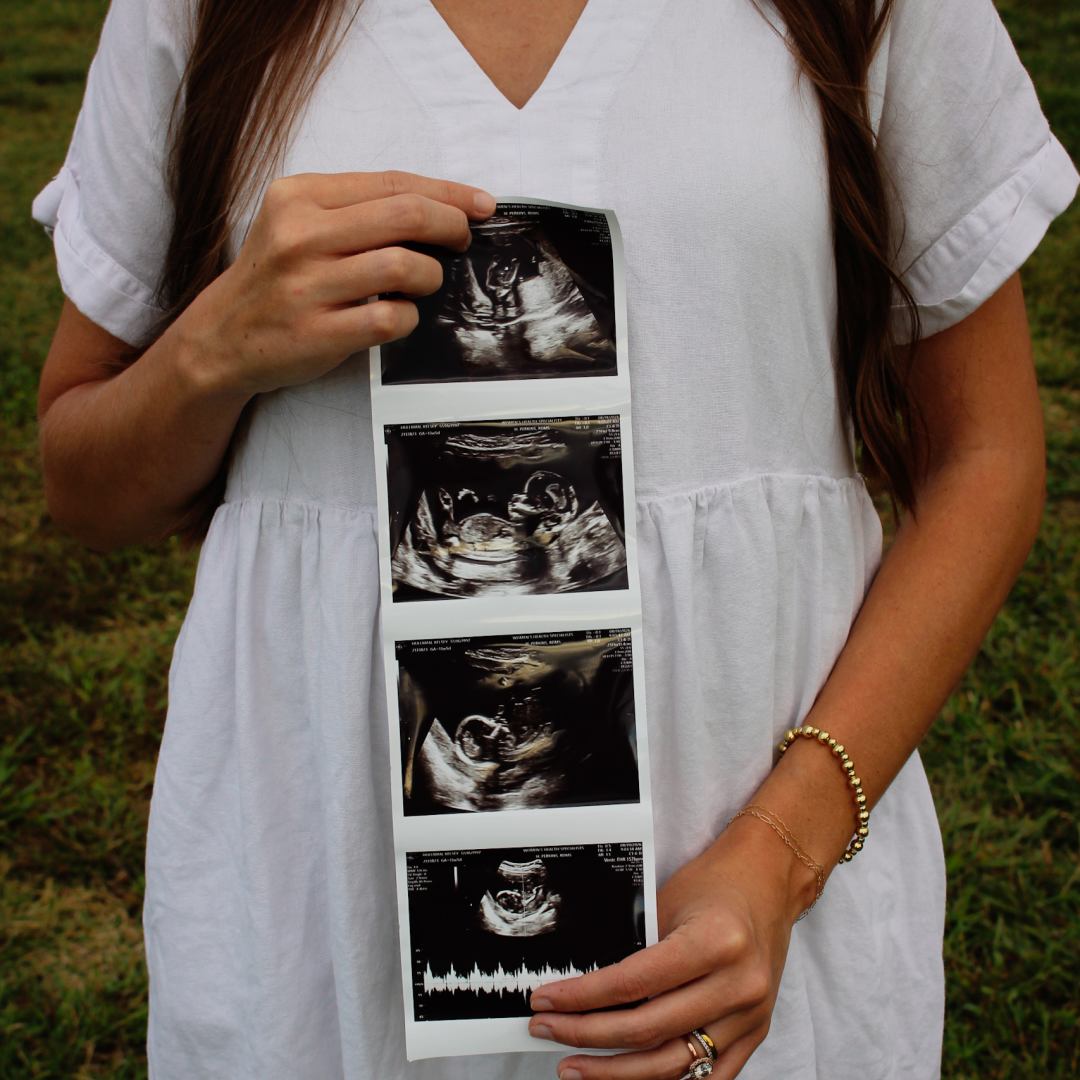 Photo shared by Kelsey for their Babylist baby registry.