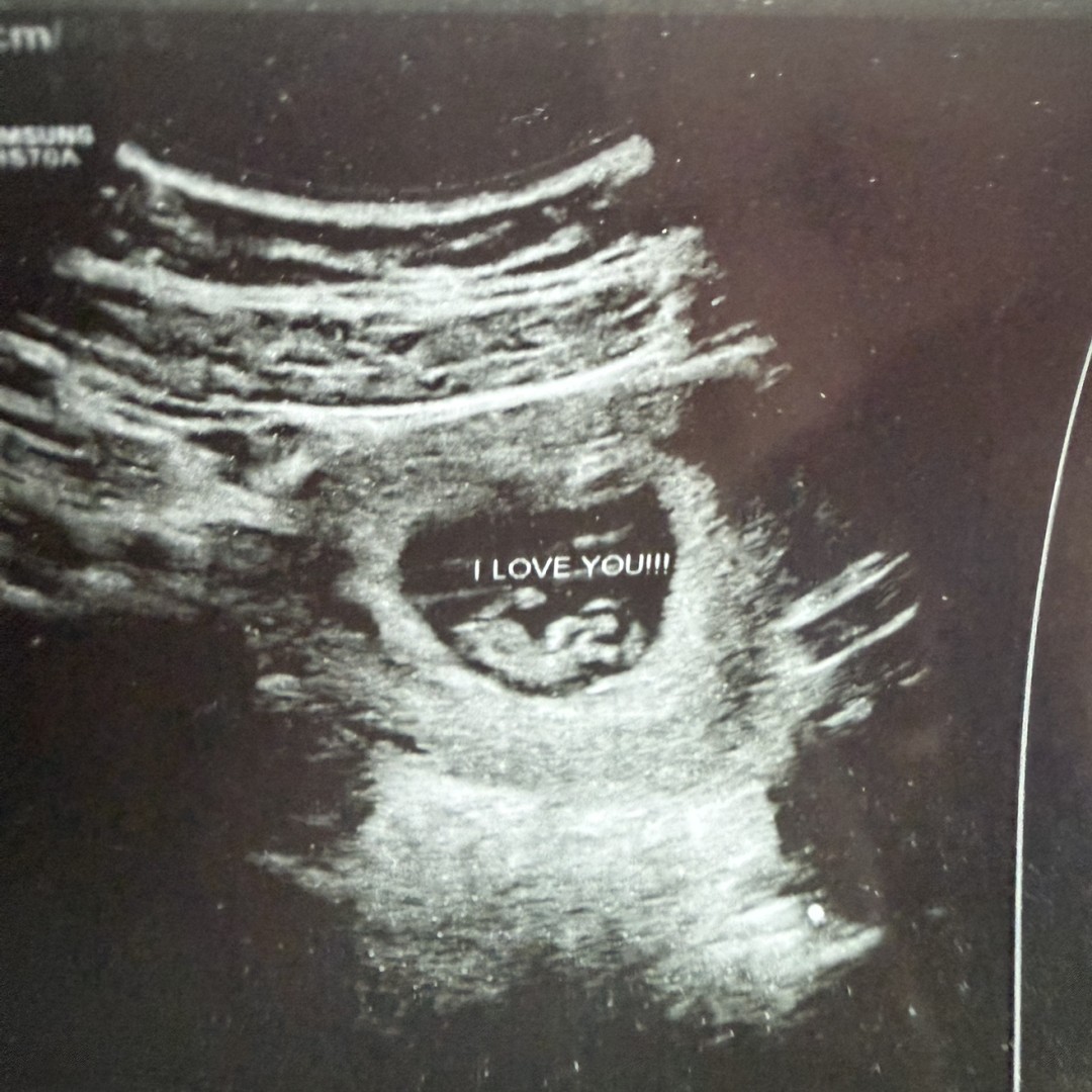 Photo shared by Katie and Gabby for their Babylist baby registry.