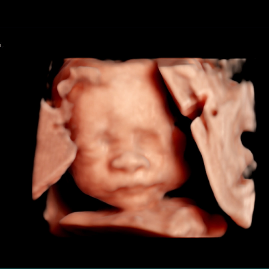 Photo shared by Ana for their Babylist baby registry.