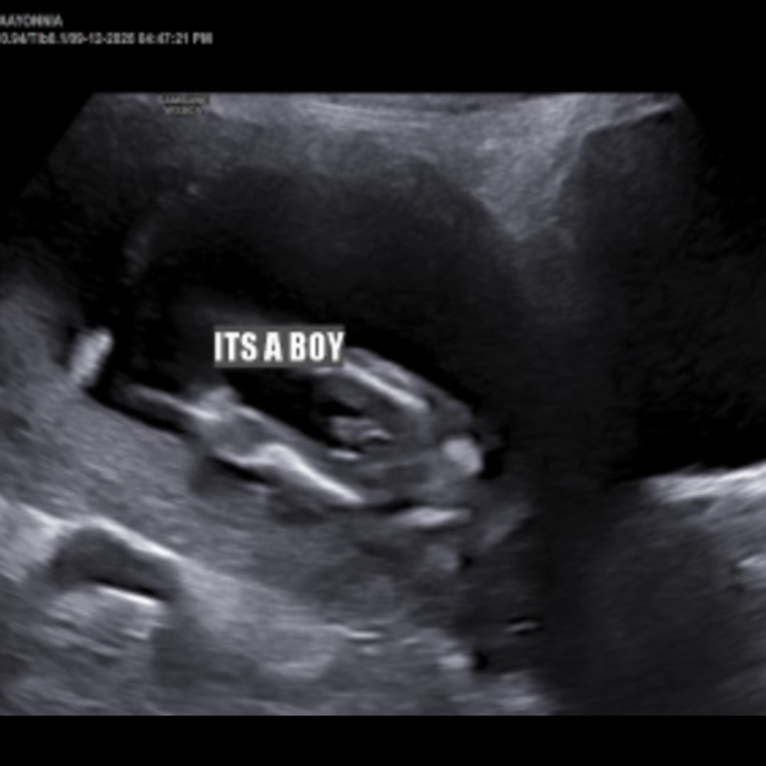 Photo shared by Jaayonnia for their Babylist baby registry.