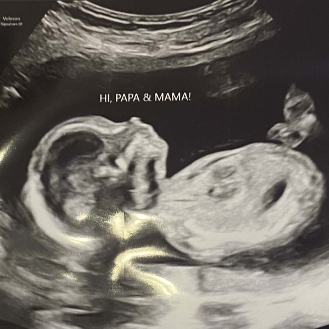 Photo shared by Emry for their Babylist baby registry.