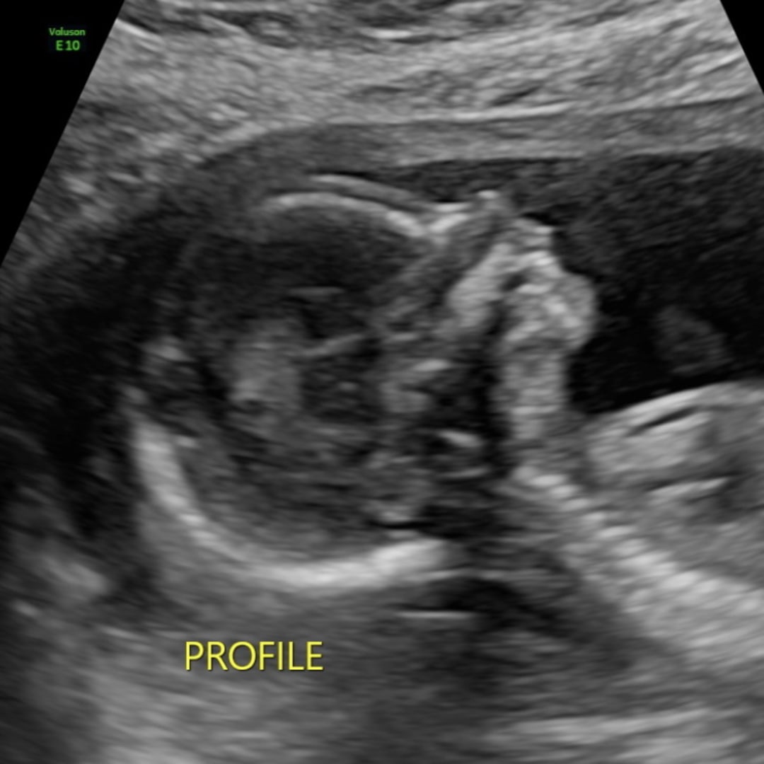 Photo shared by Kadynce for their Babylist baby registry.