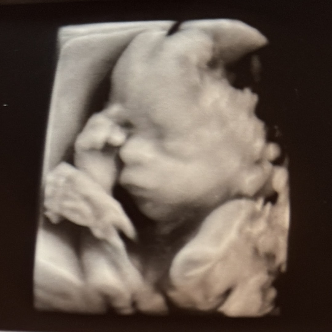 Photo shared by Tabitha for their Babylist baby registry.