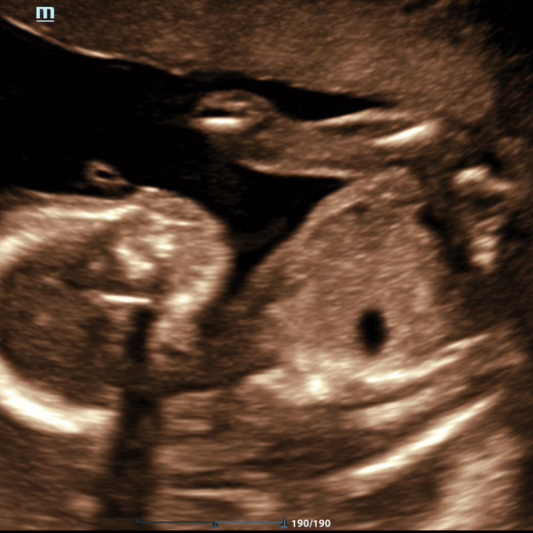 Photo shared by Miranda for their Babylist baby registry.