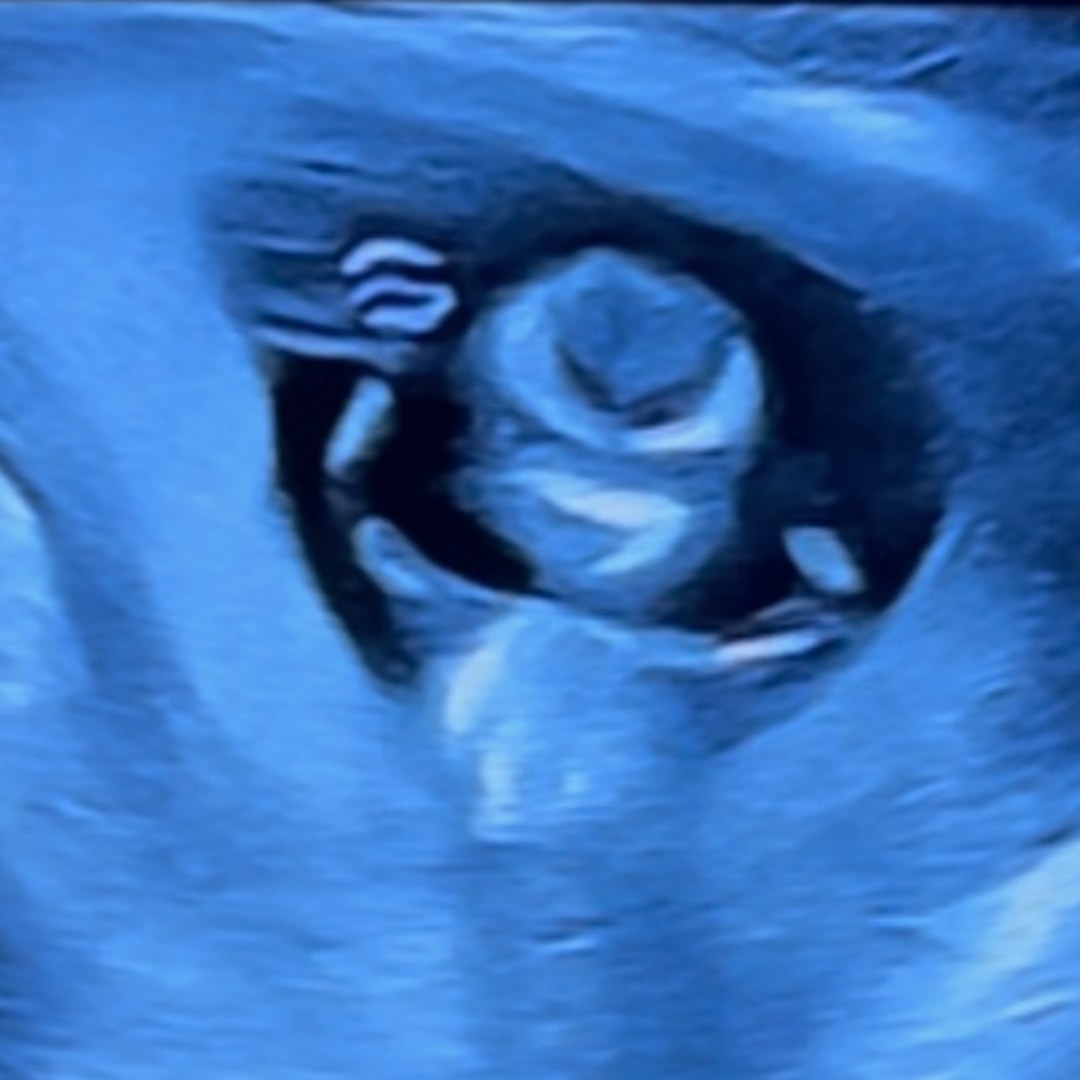 Photo shared by Katie for their Babylist baby registry.