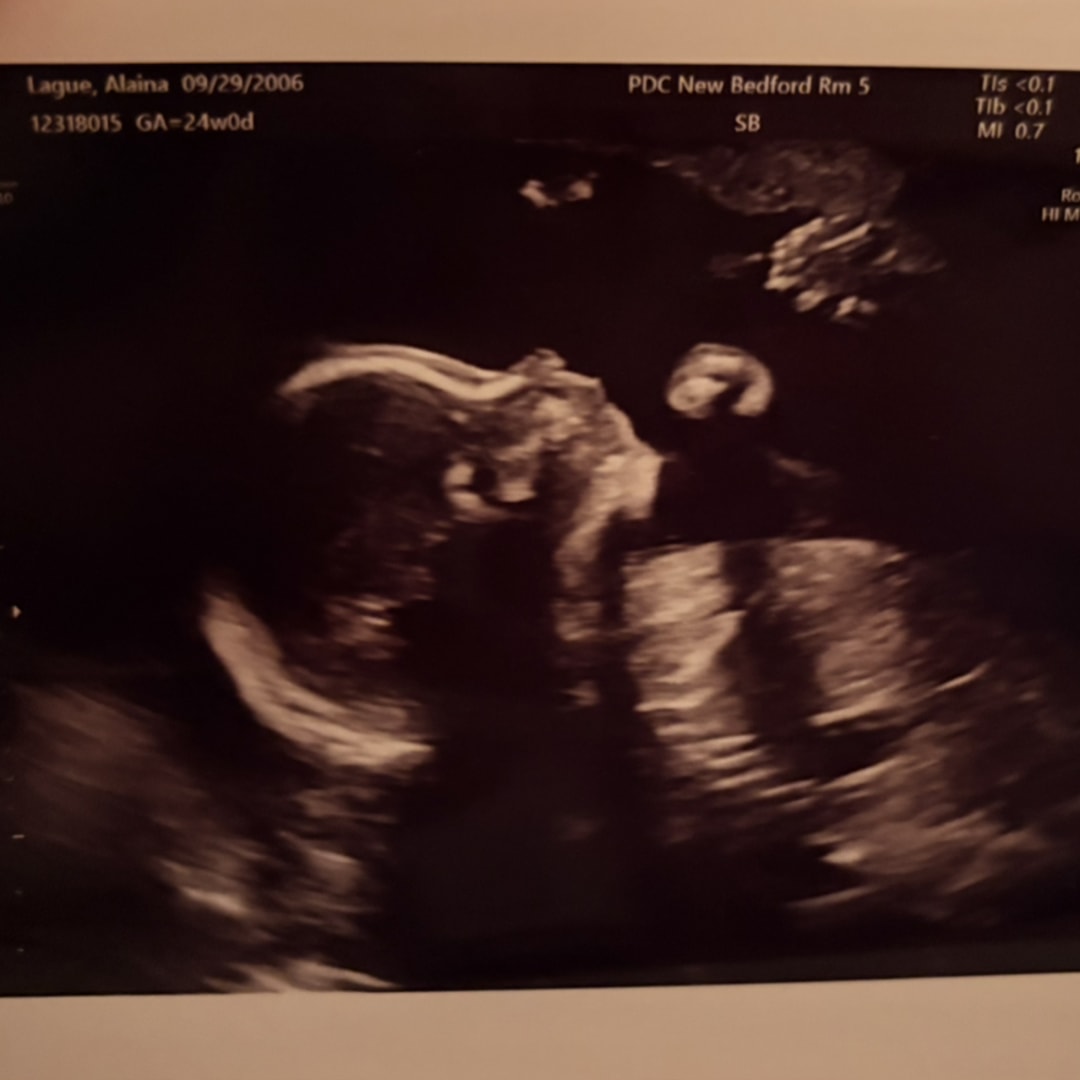 Photo shared by Alaina for their Babylist baby registry.