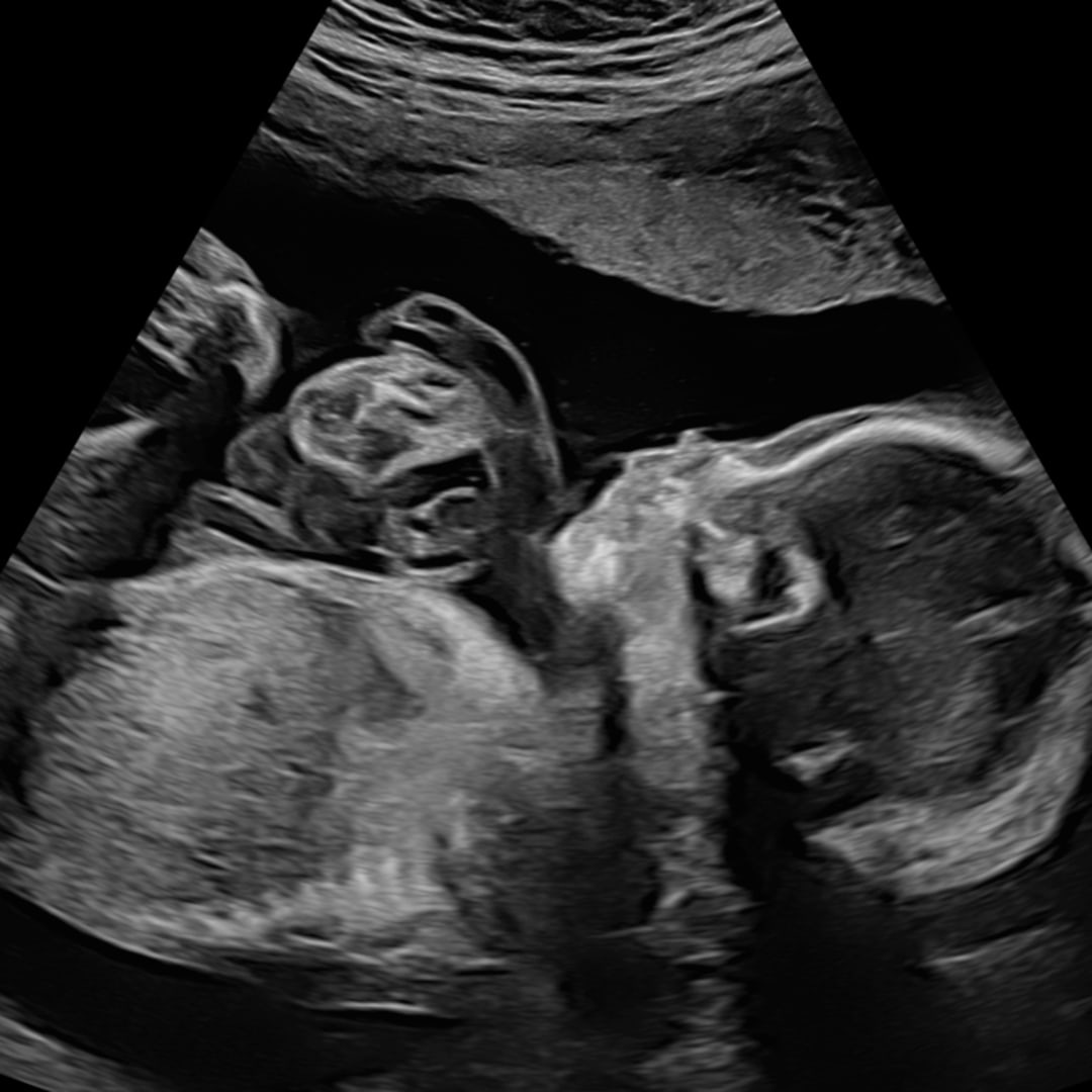Photo shared by Gillian for their Babylist baby registry.