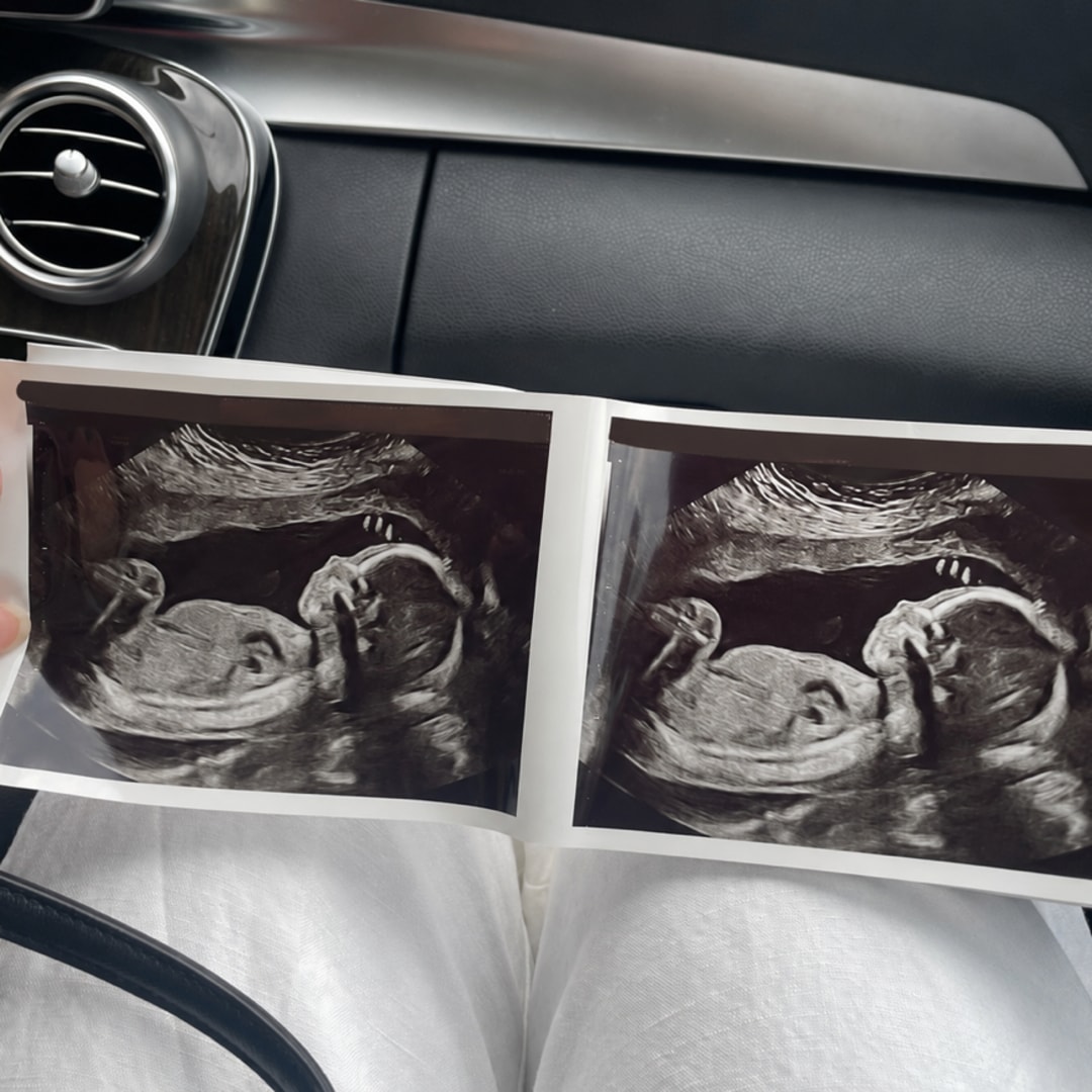 Photo shared by Brendalys for their Babylist baby registry.