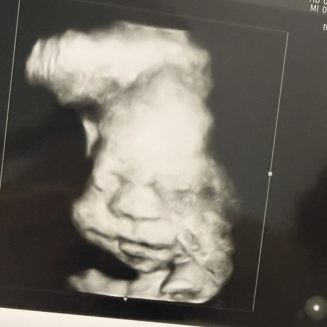 Photo shared by Shanthornie for their Babylist baby registry.
