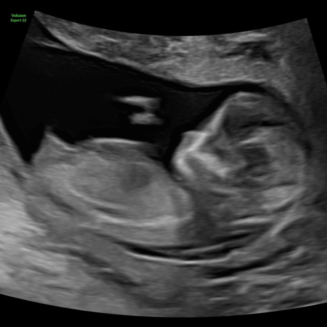 Photo shared by Faith for their Babylist baby registry.