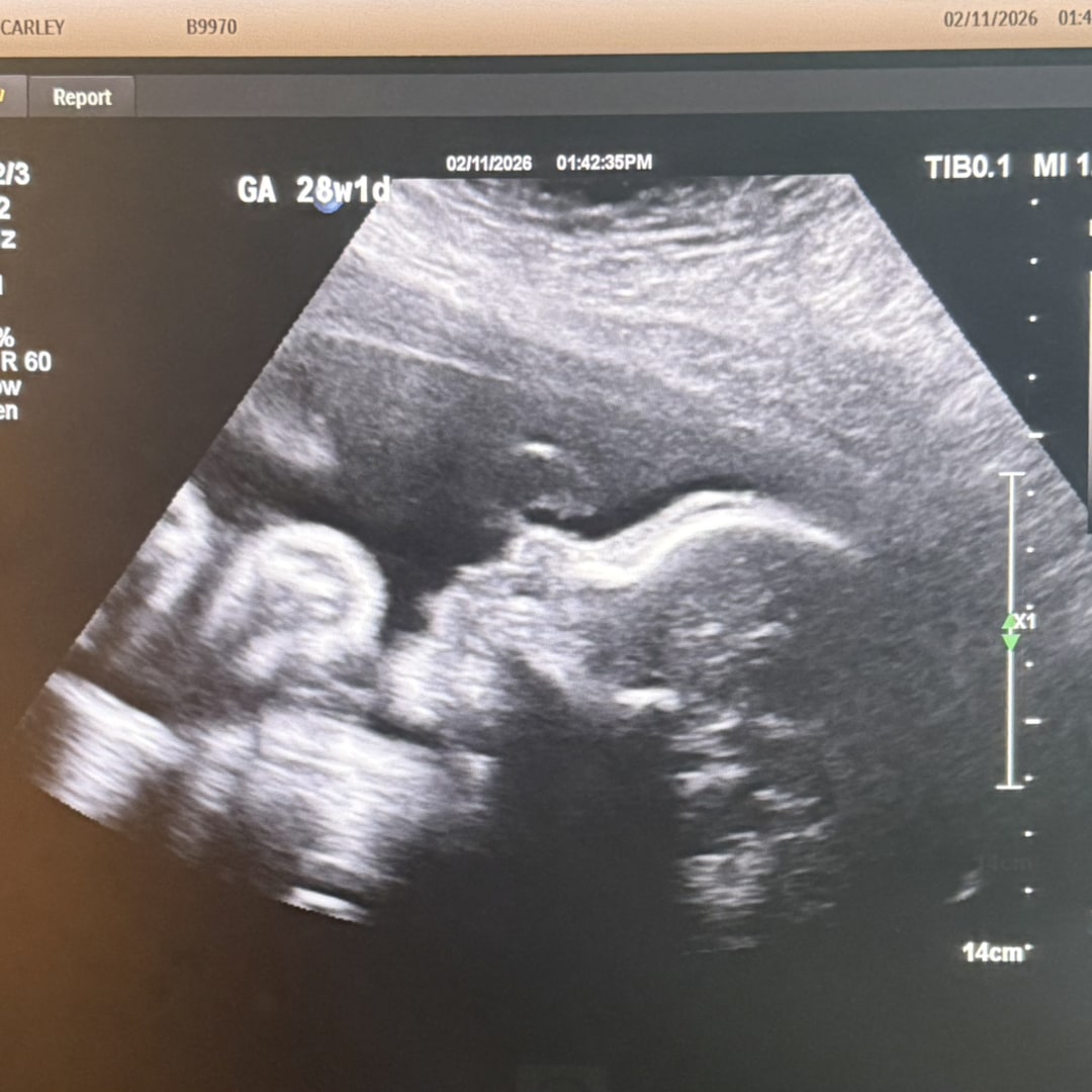 Photo shared by Carley for their Babylist baby registry.