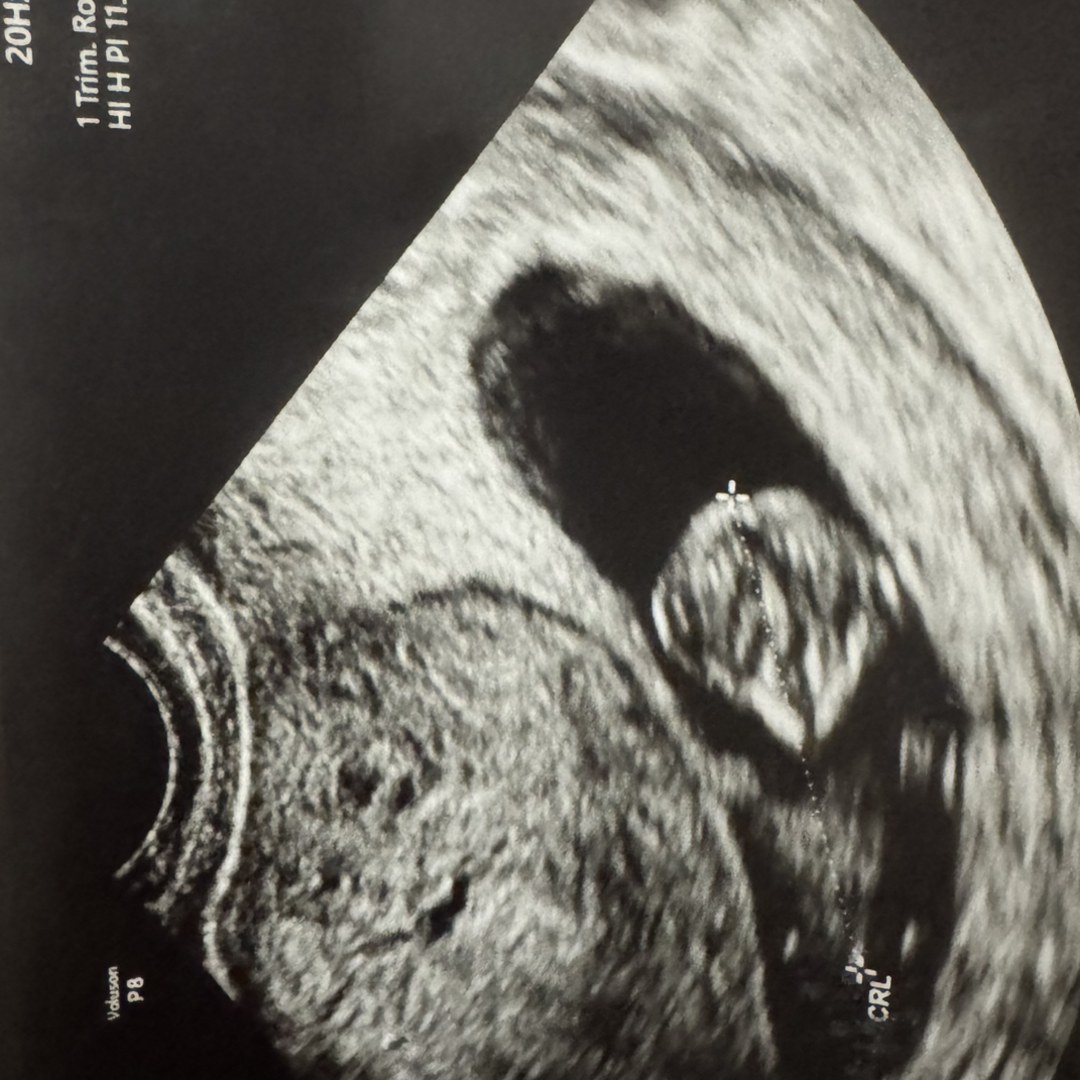 Photo shared by Nevaeh for their Babylist baby registry.