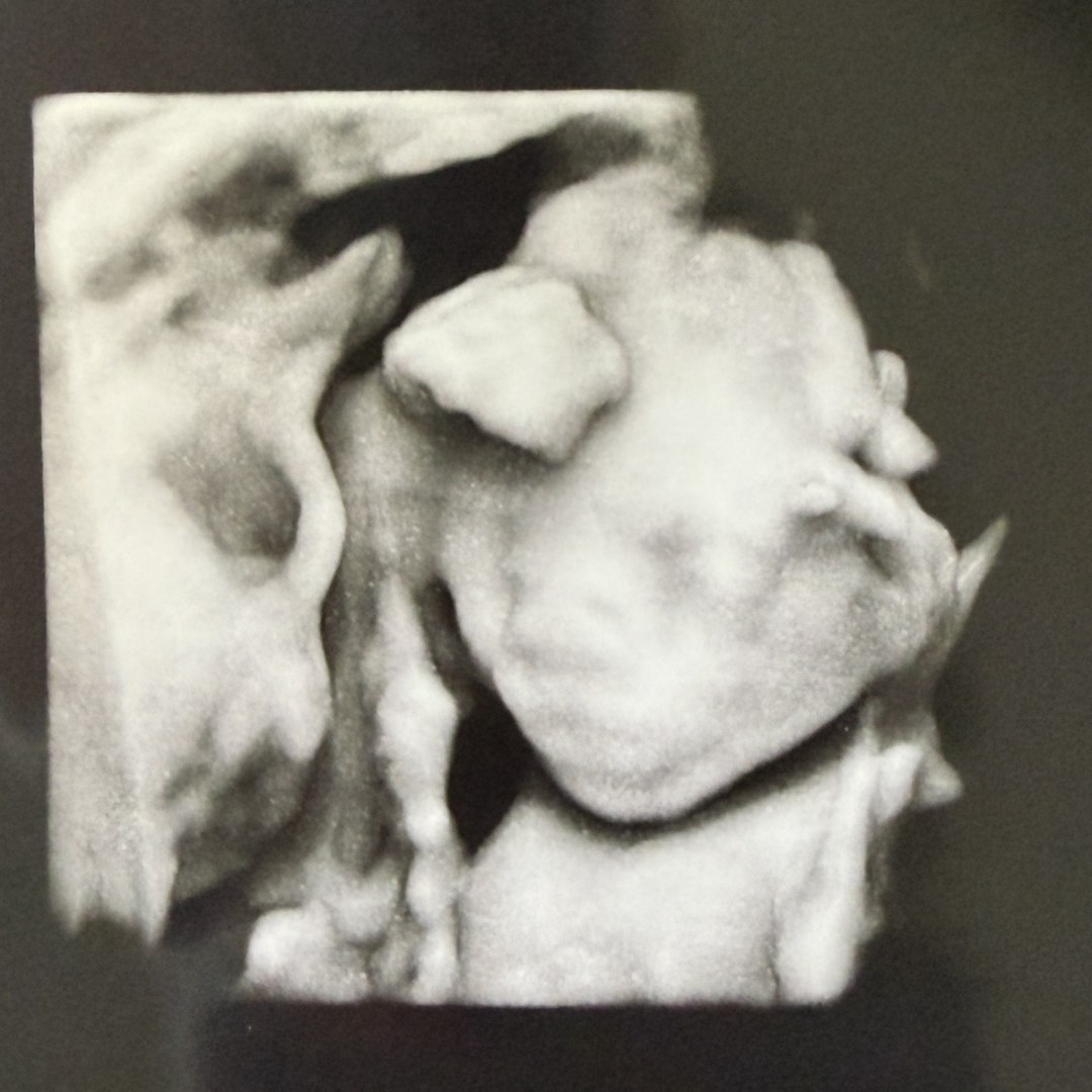 Photo shared by Bailey for their Babylist baby registry.