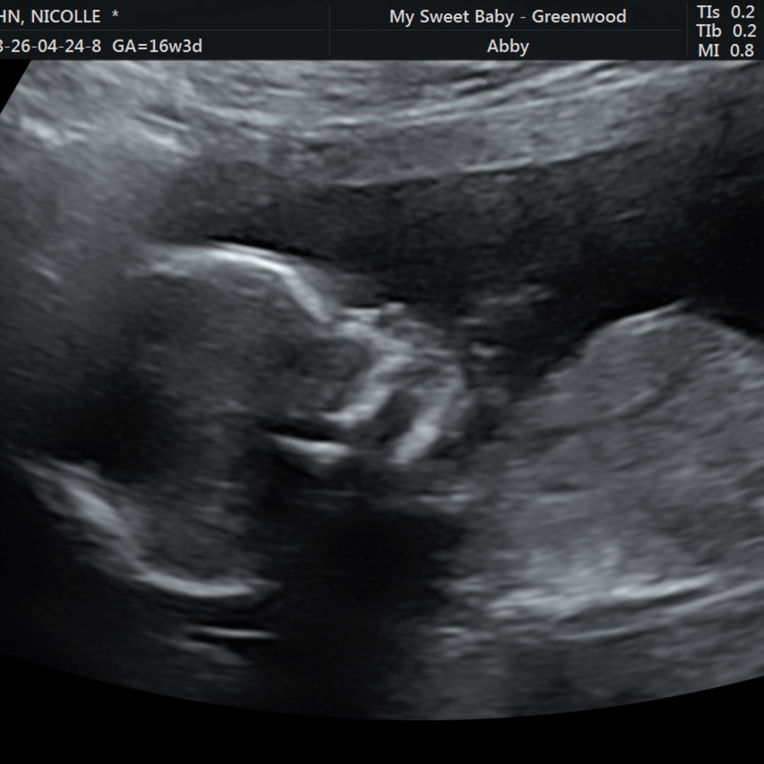 Photo shared by Nikki for their Babylist baby registry.