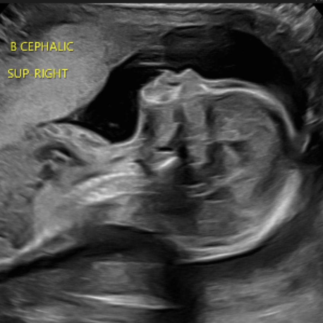 Photo shared by Christina for their Babylist baby registry.