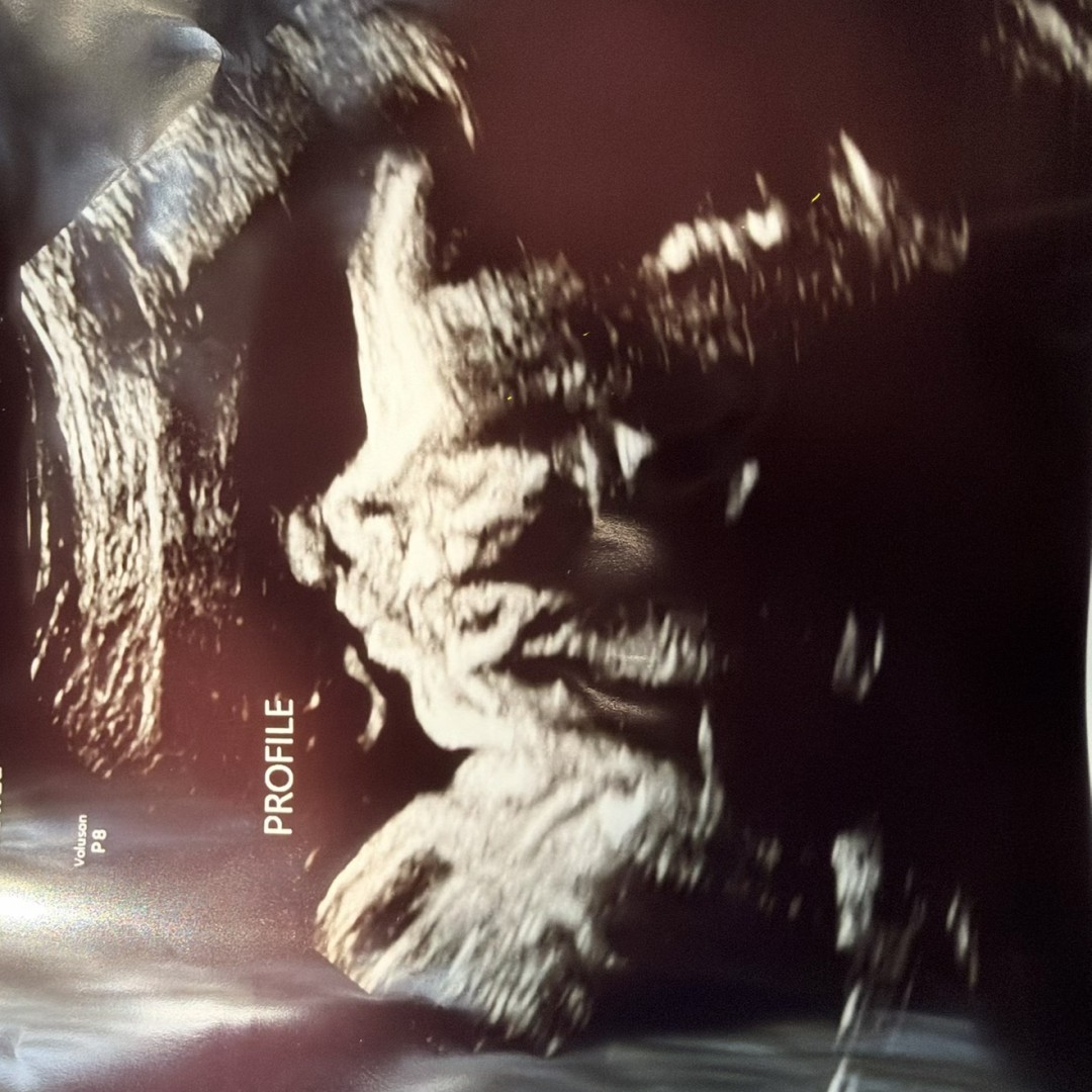 Photo shared by Cat for their Babylist baby registry.