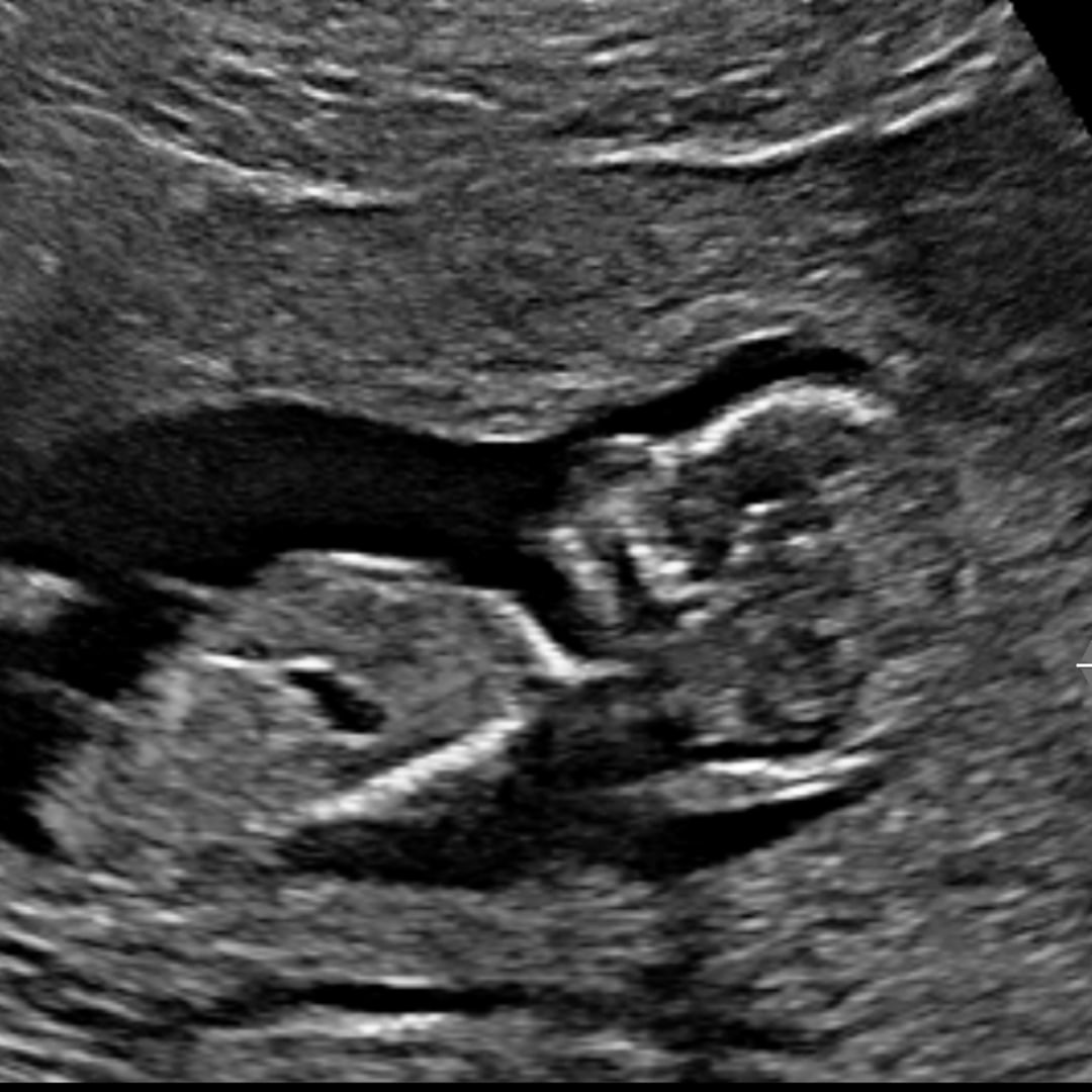 Photo shared by Teigan for their Babylist baby registry.