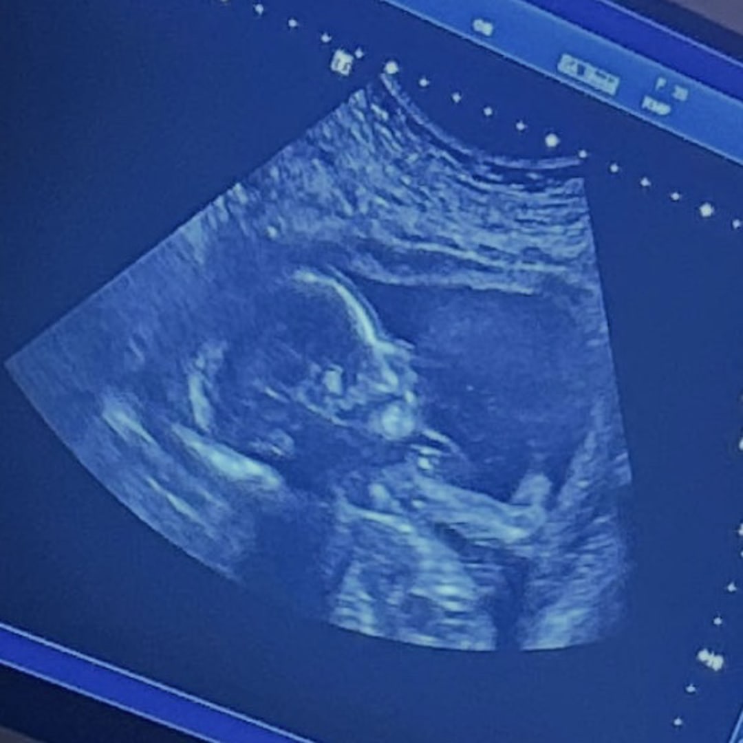 Photo shared by Layla for their Babylist baby registry.