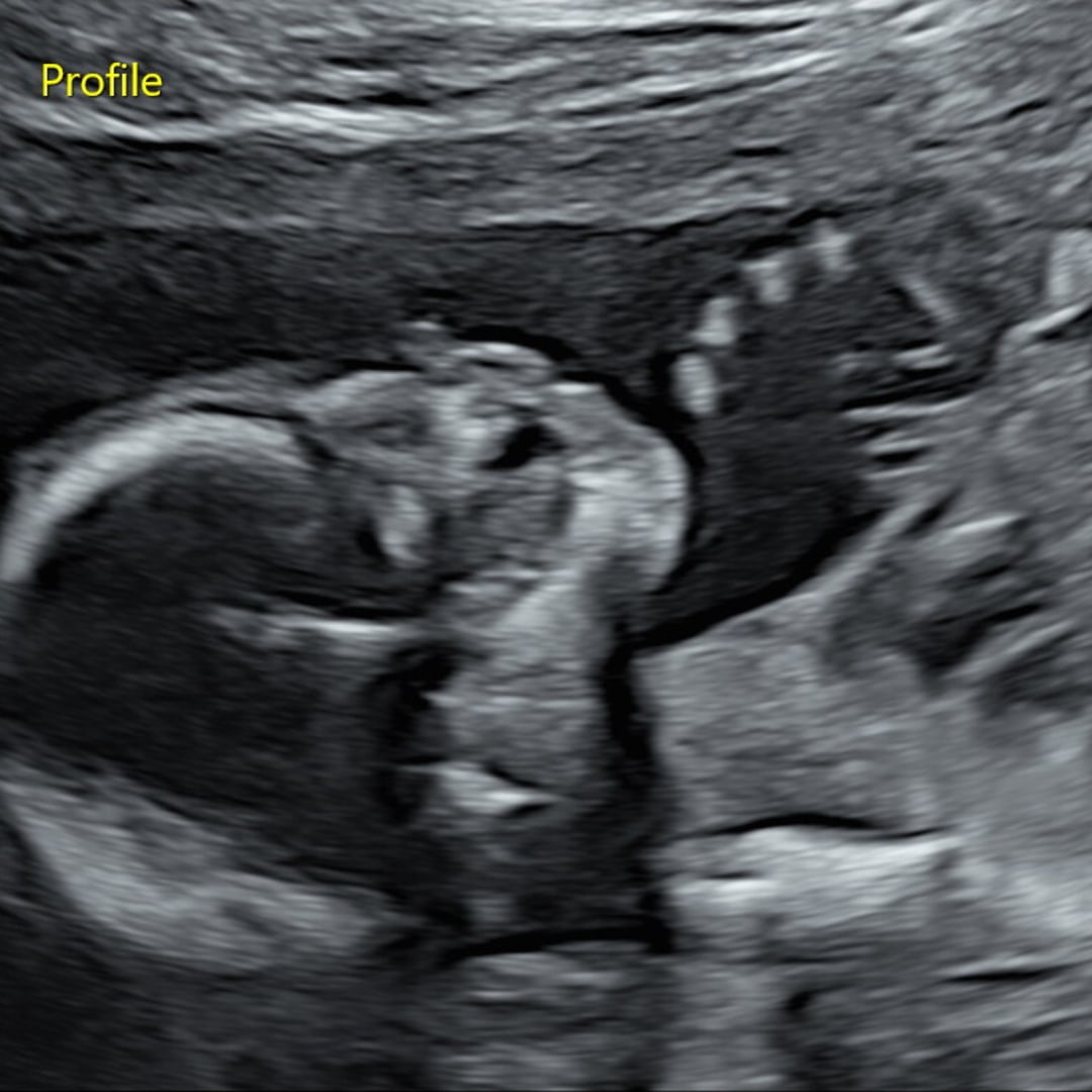 Photo shared by Ashley for their Babylist baby registry.