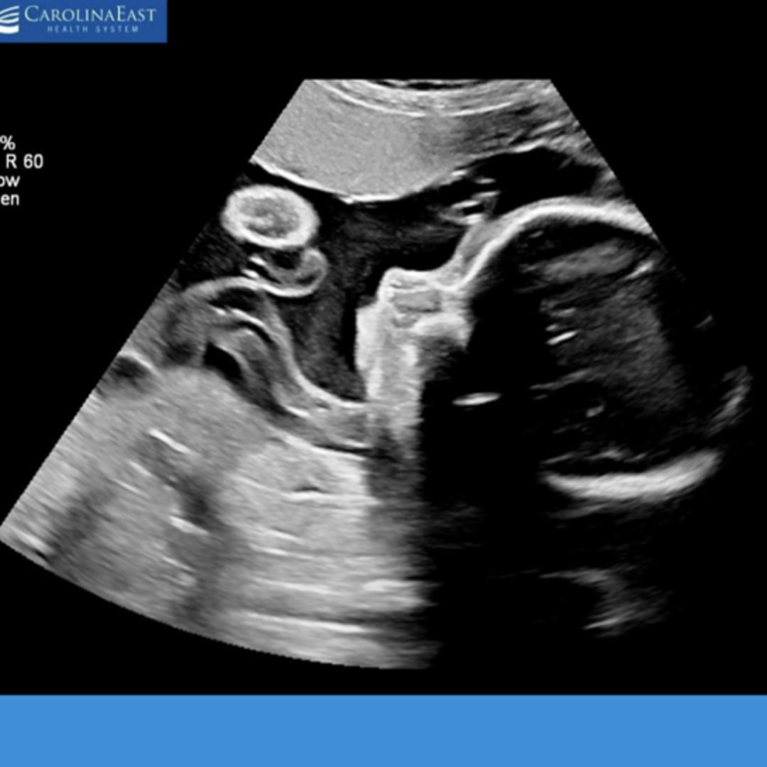 Photo shared by Abigail for their Babylist baby registry.