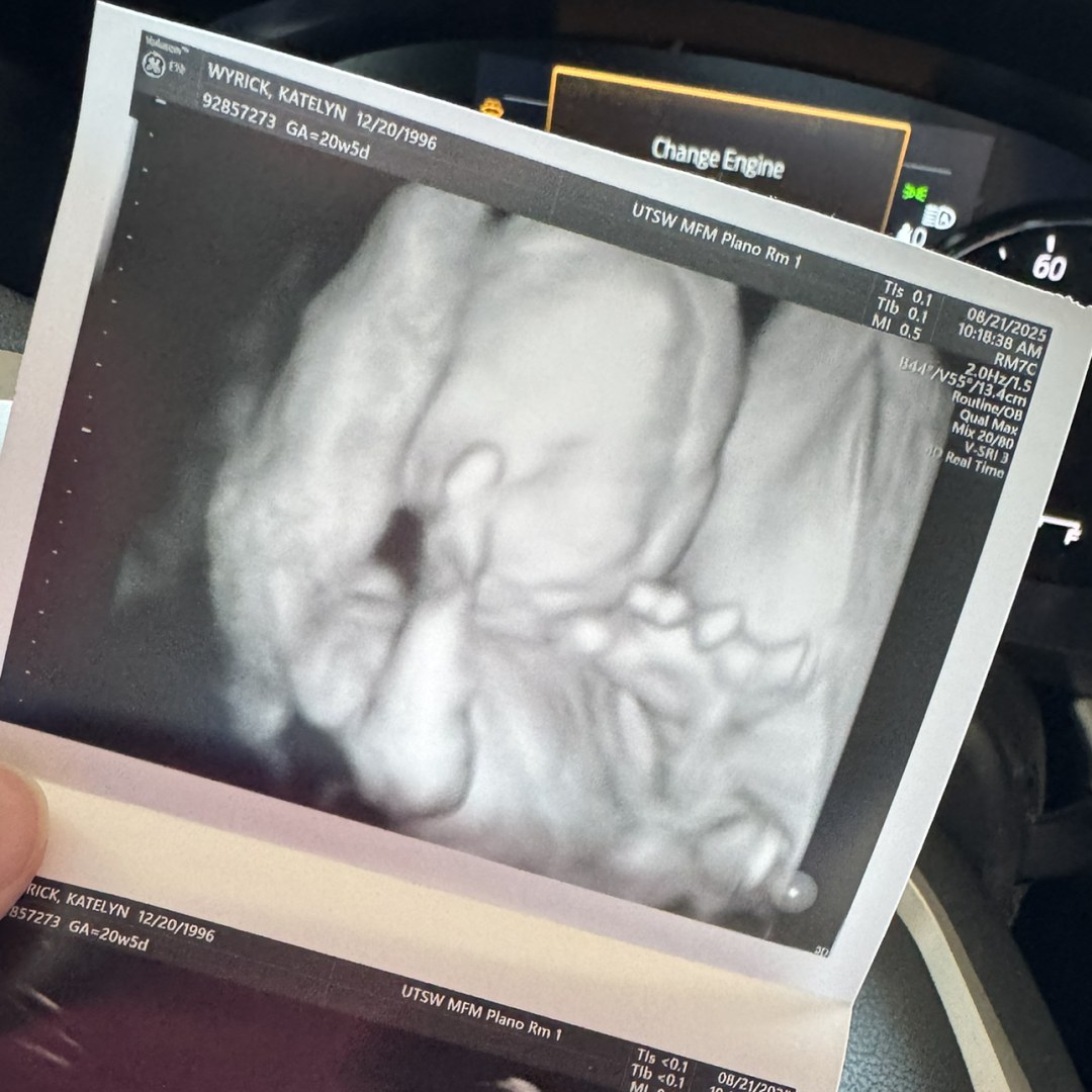 Photo shared by Katie for their Babylist baby registry.
