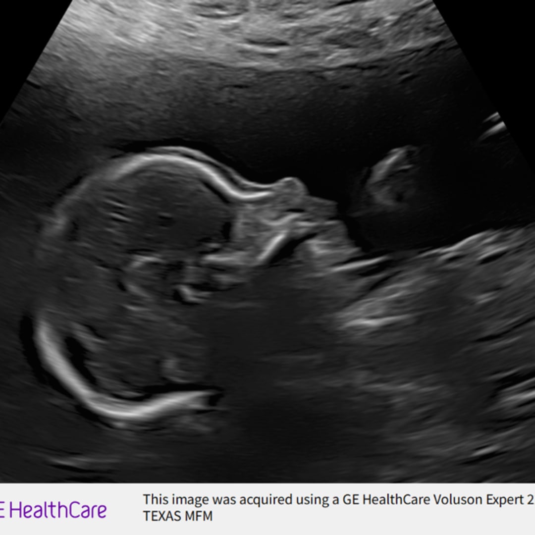 Photo shared by Jessica for their Babylist baby registry.