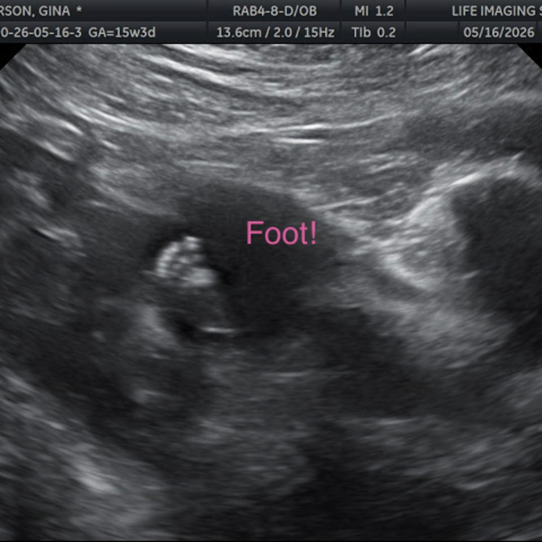 Photo shared by Ginamarie & Julien for their Babylist baby registry.