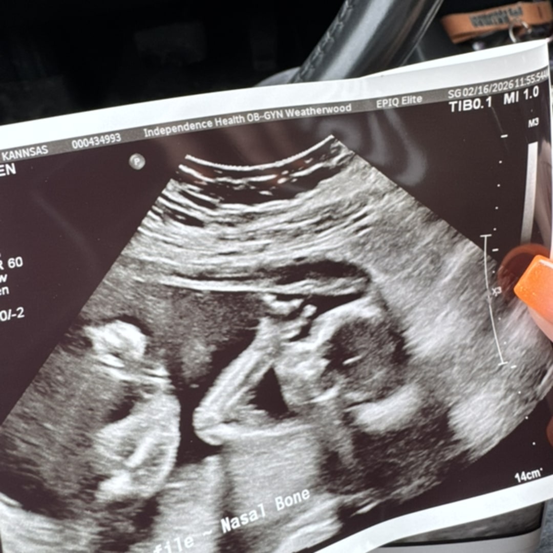 Photo shared by Kannsas for their Babylist baby registry.