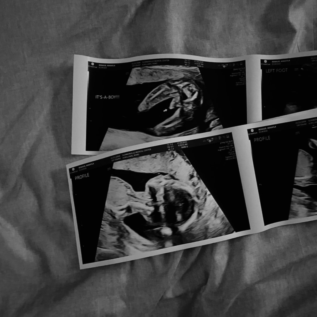 Photo shared by Makayla for their Babylist baby registry.