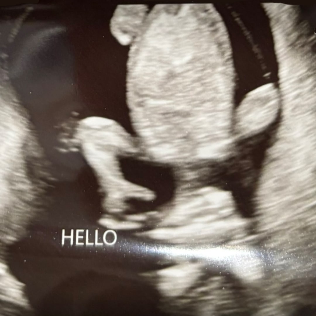 Photo shared by Adamaris for their Babylist baby registry.