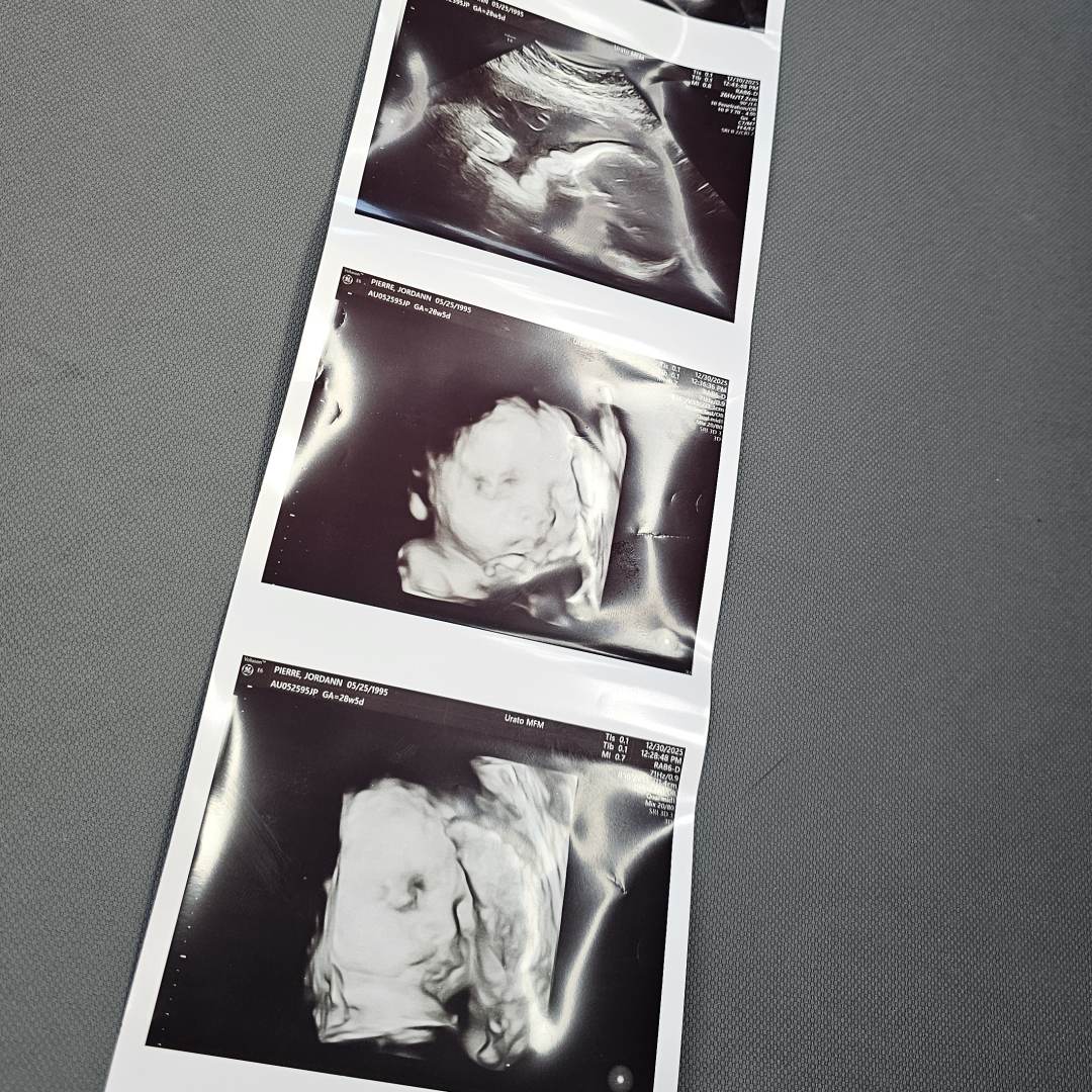 Photo shared by Jordann for their Babylist baby registry.