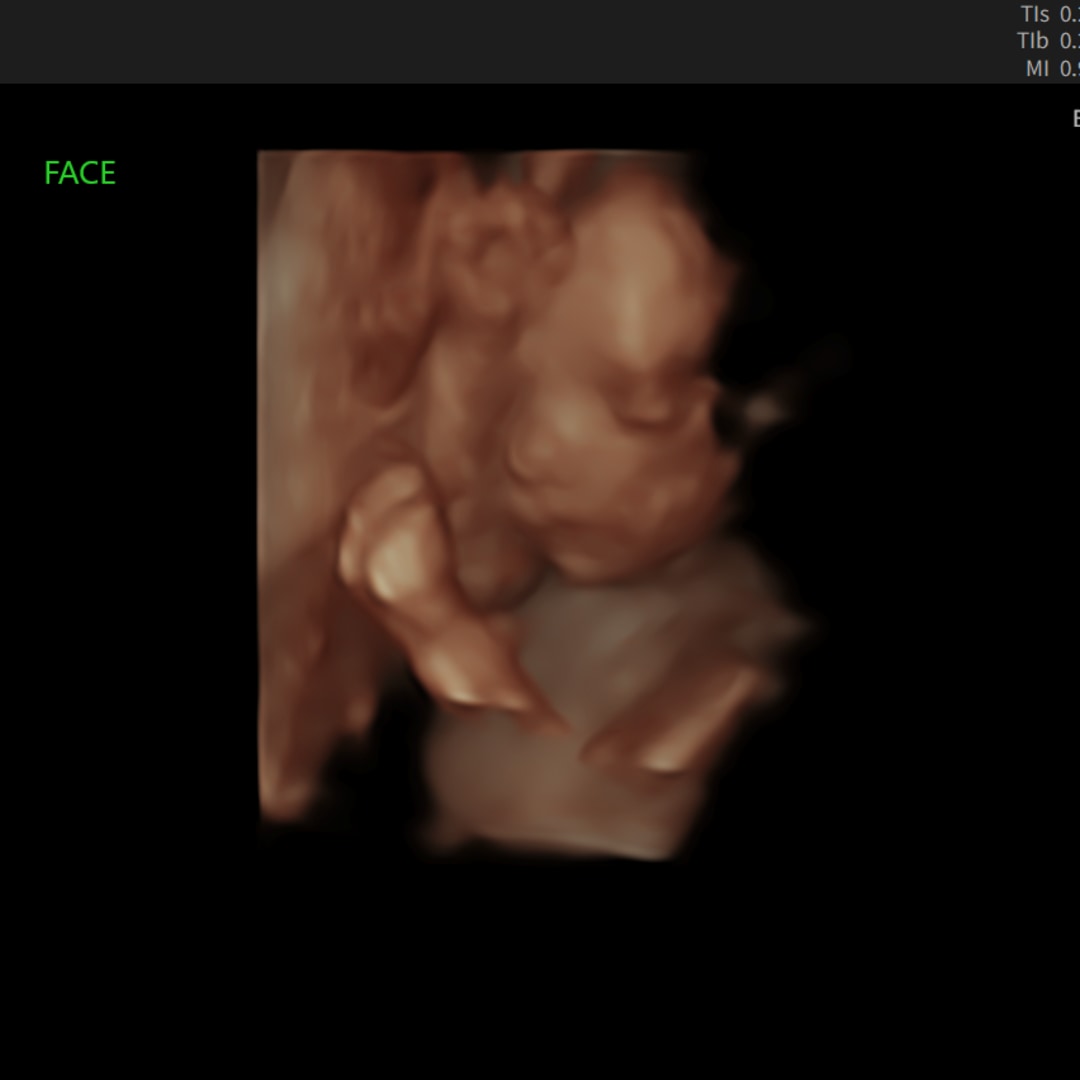 Photo shared by Katie for their Babylist baby registry.