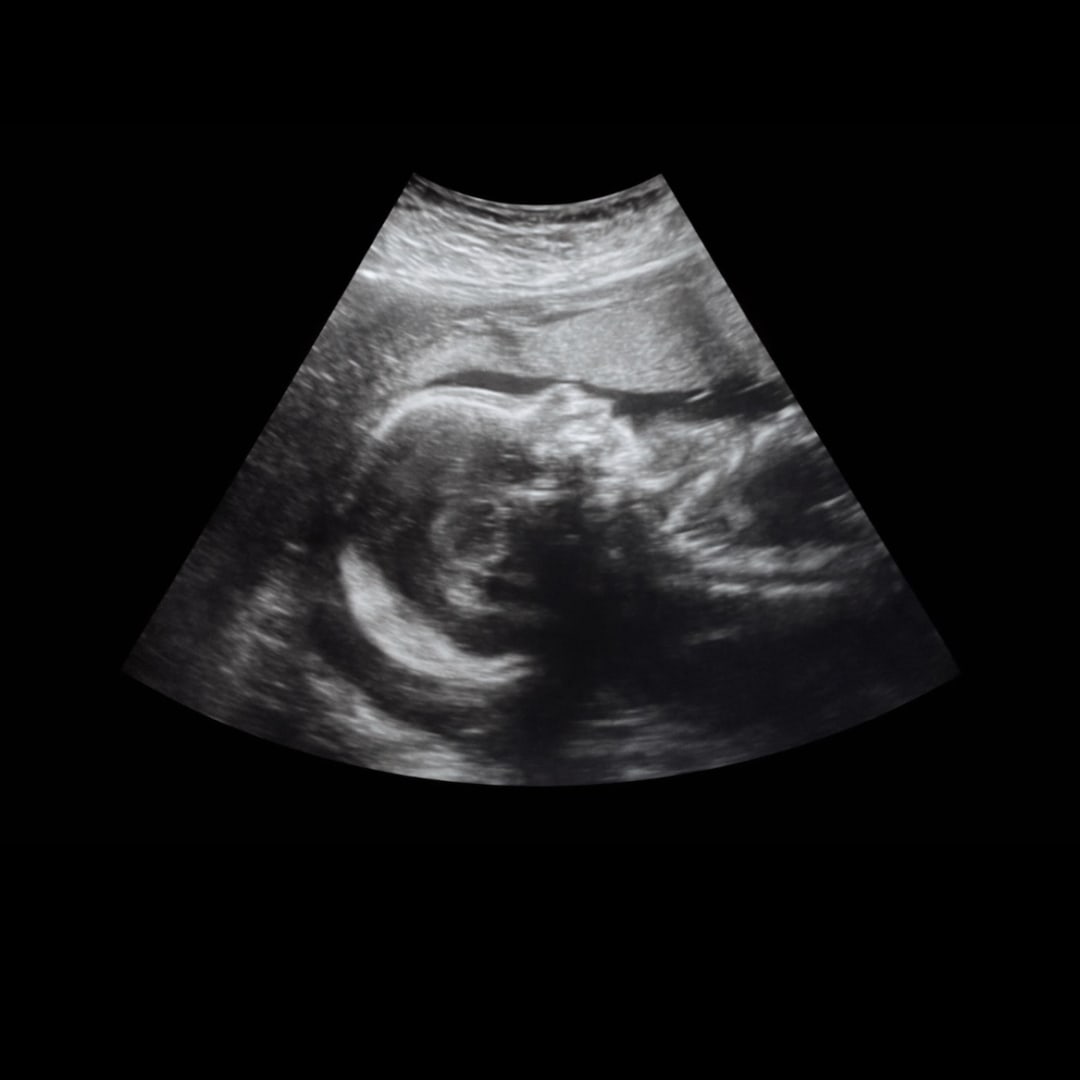 Photo shared by Angel for their Babylist baby registry.