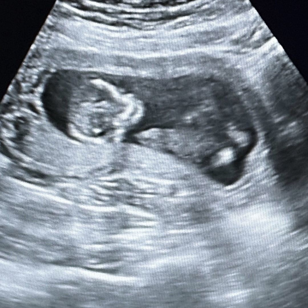 Photo shared by Aubrey for their Babylist baby registry.
