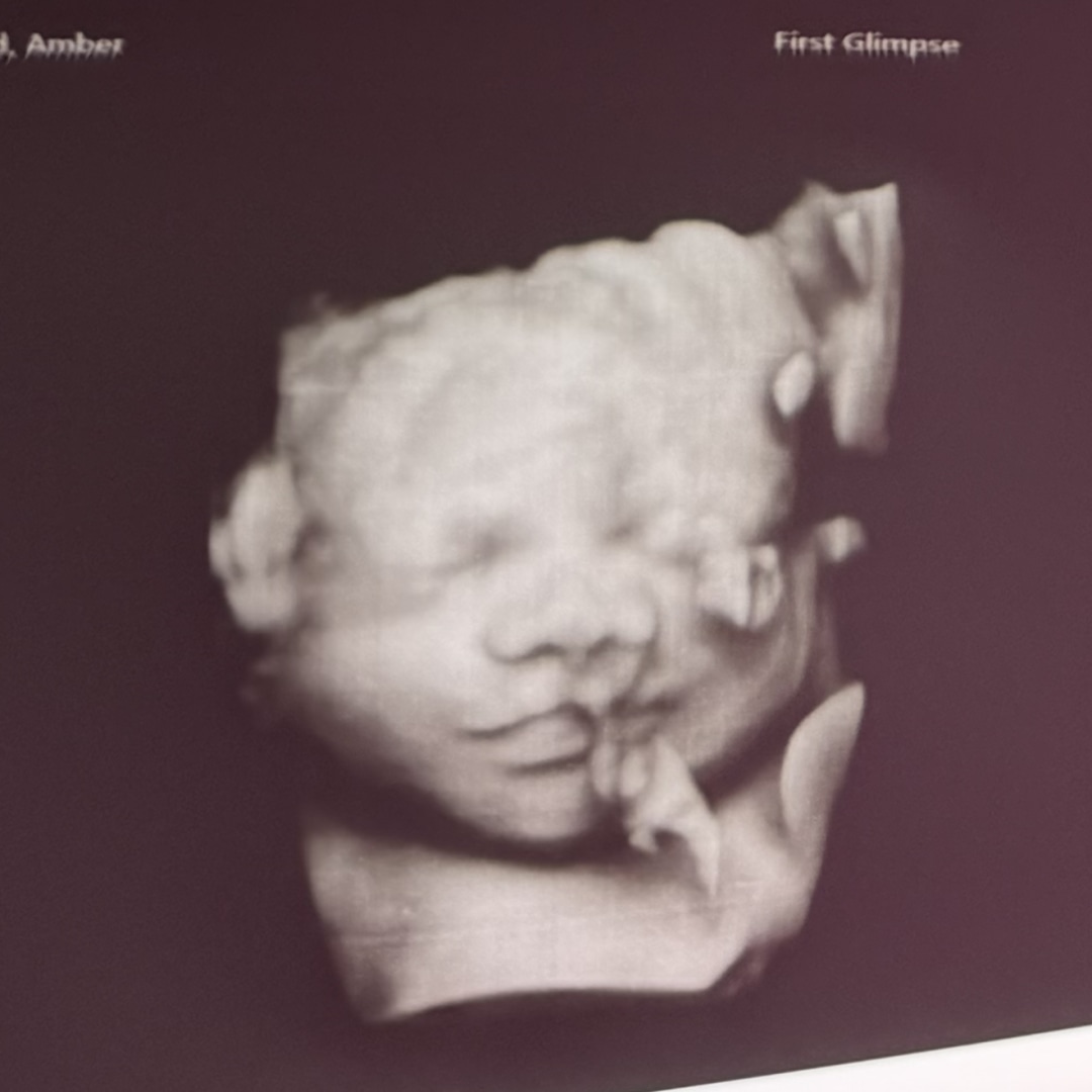 Photo shared by Amber for their Babylist baby registry.