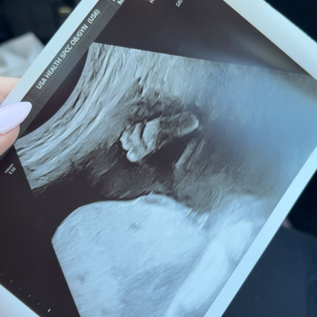 Photo shared by Jade for their Babylist baby registry.