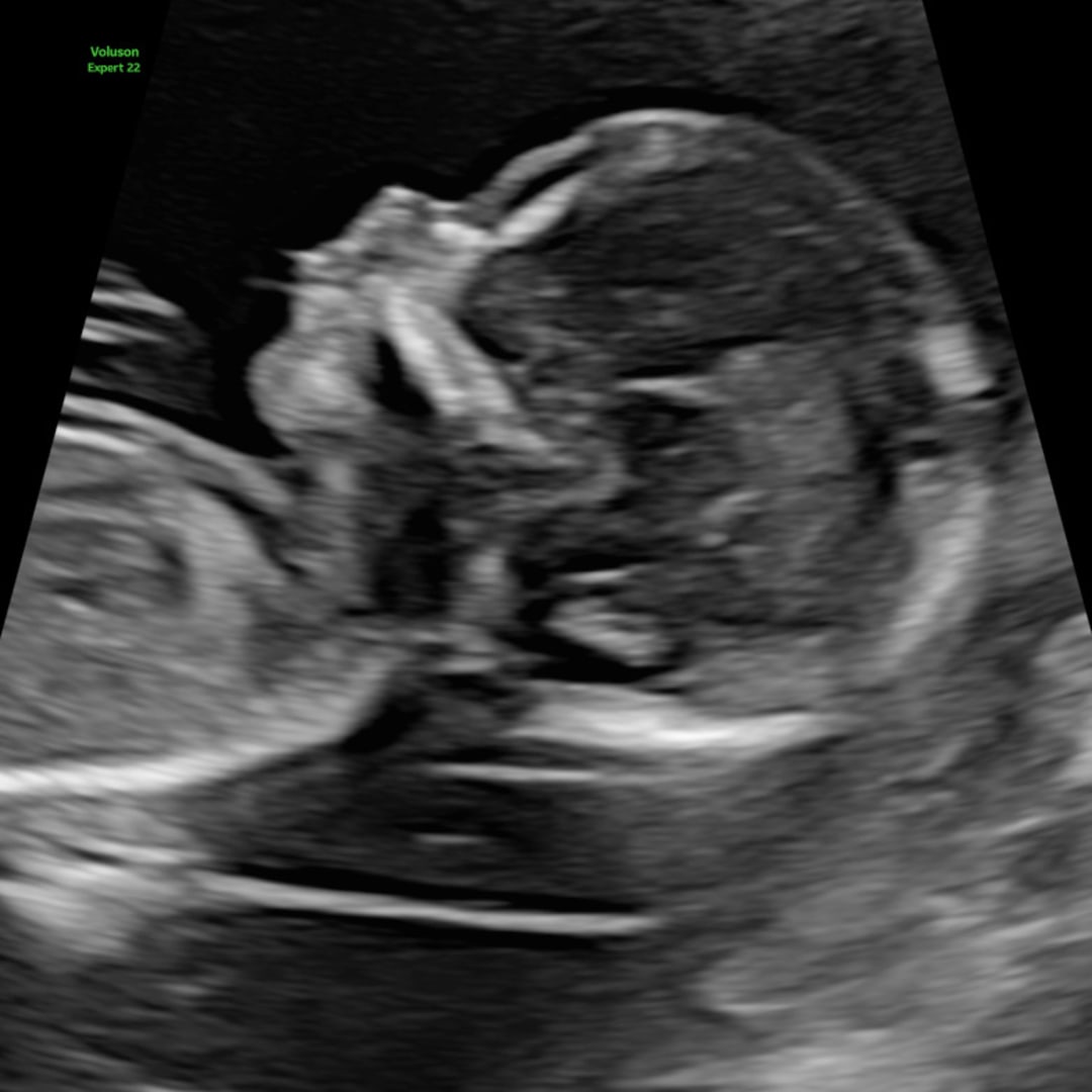 Photo shared by Paula for their Babylist baby registry.