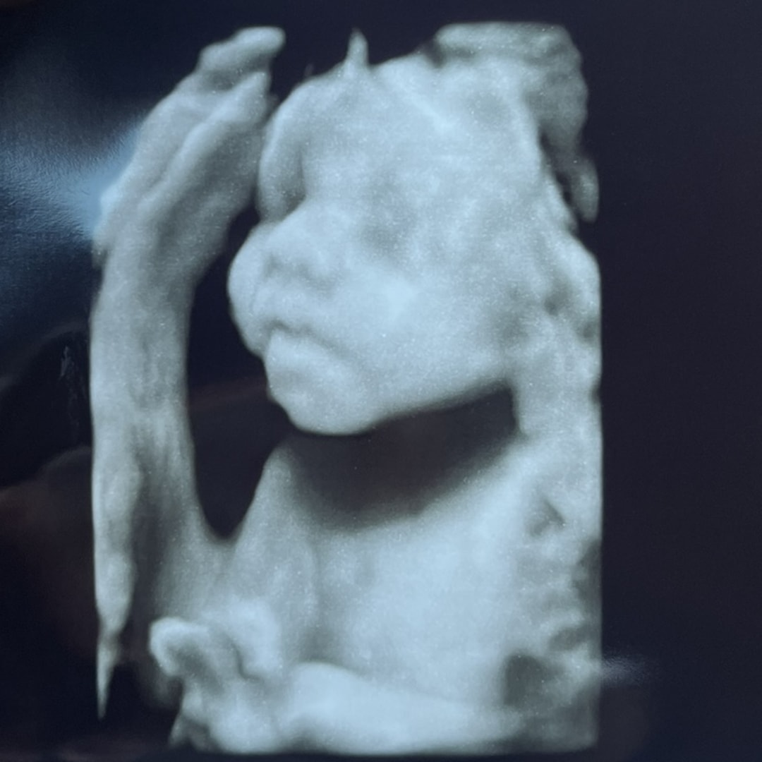 Photo shared by Kaitlin for their Babylist baby registry.