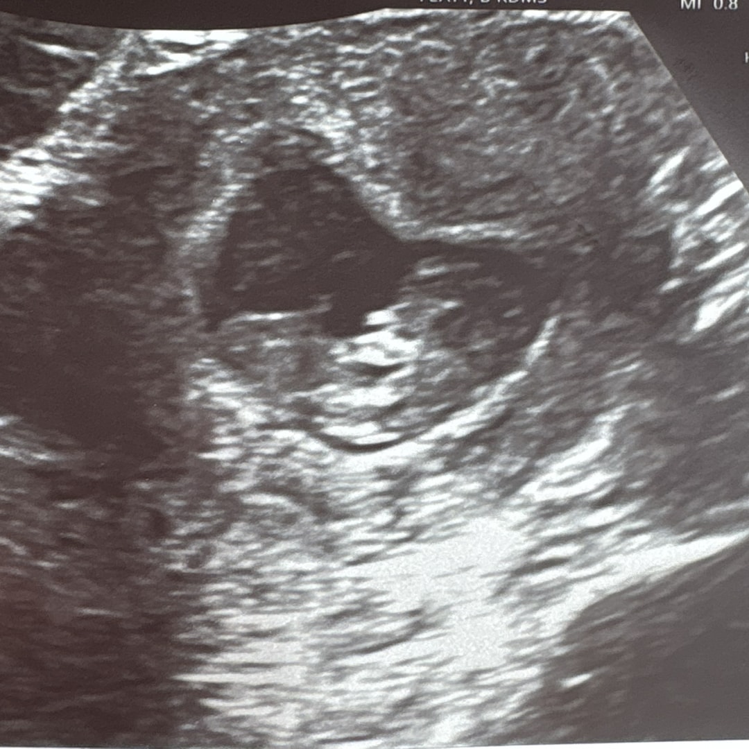 Photo shared by Cheyenne for their Babylist baby registry.