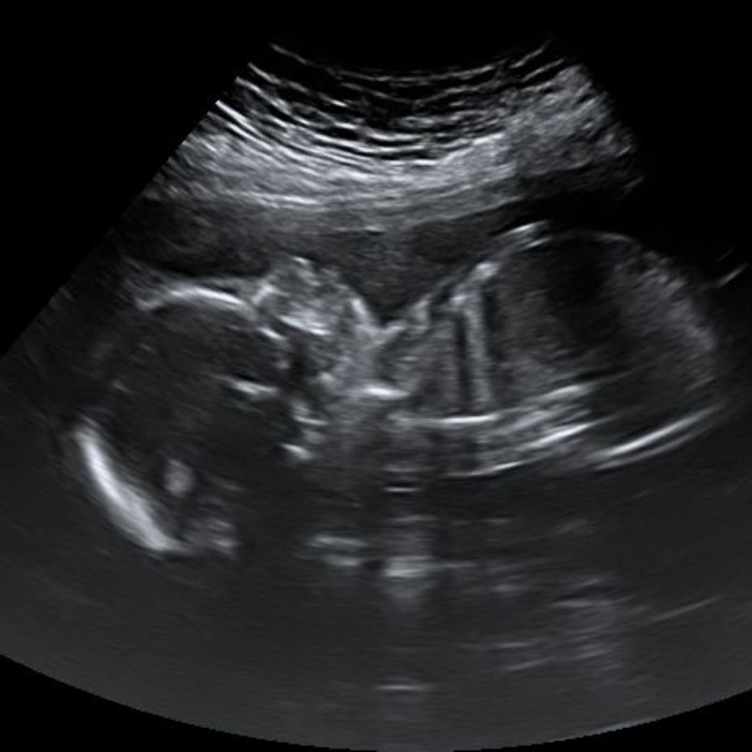 Photo shared by Sydney for their Babylist baby registry.