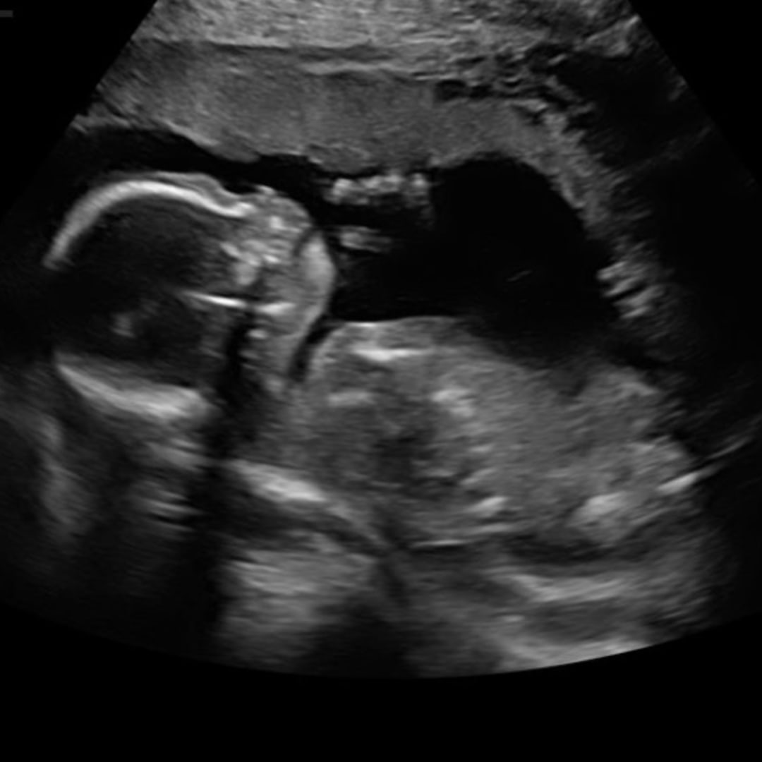Photo shared by Ashley for their Babylist baby registry.