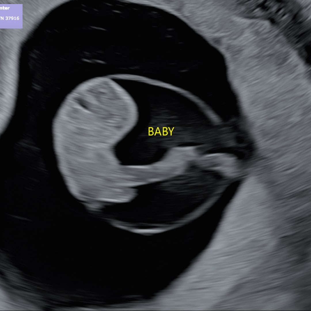Photo shared by Emilee for their Babylist baby registry.