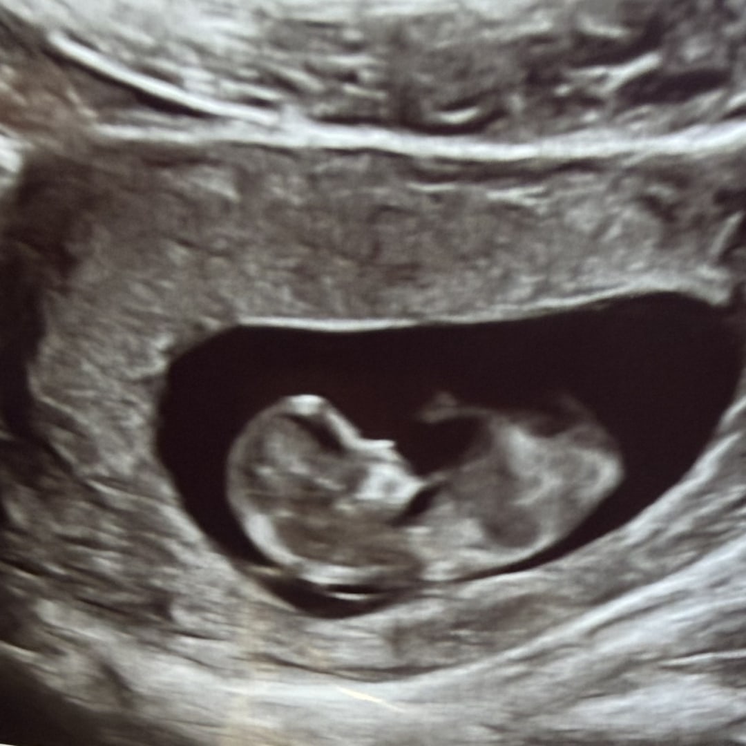 Photo shared by Cristen for their Babylist baby registry.