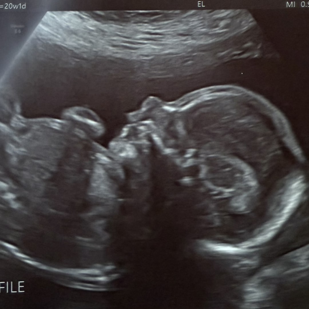 Photo shared by Andrea for their Babylist baby registry.