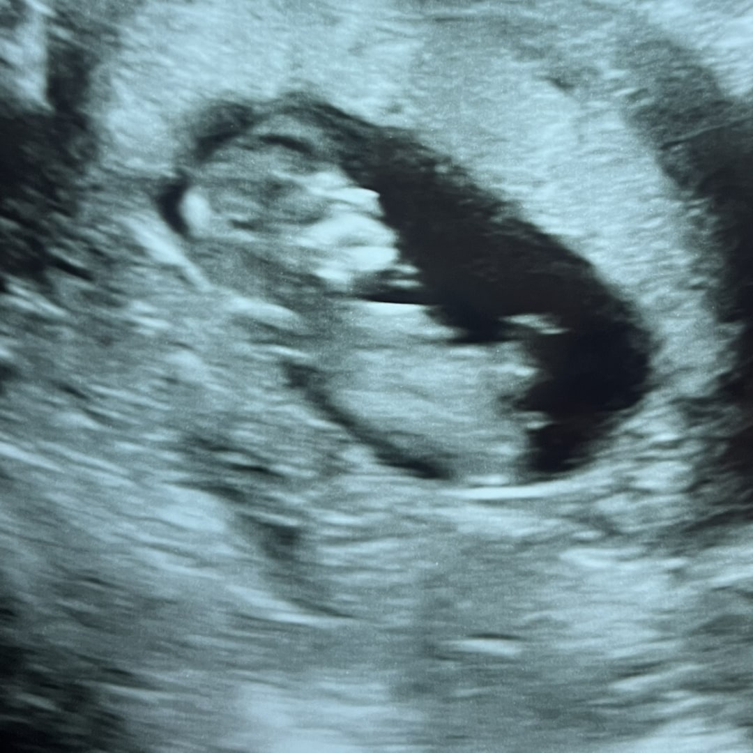 Photo shared by Katie for their Babylist baby registry.