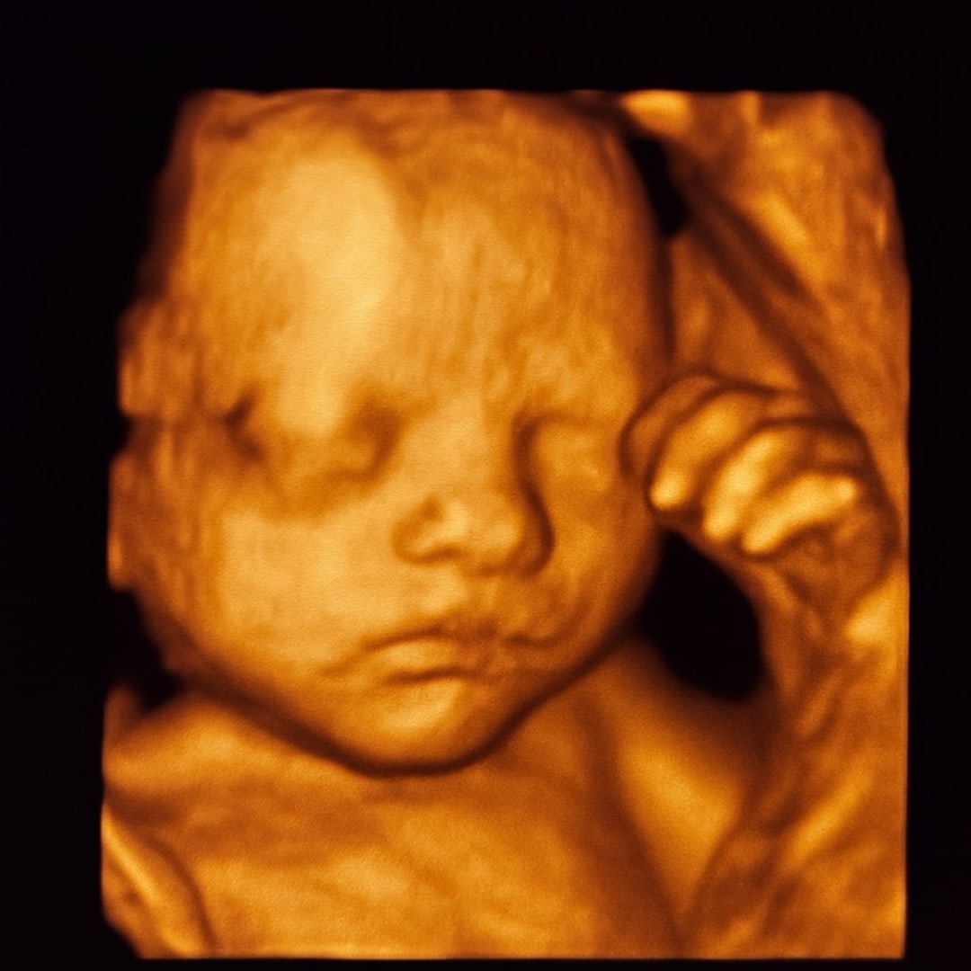 Photo shared by Joice for their Babylist baby registry.